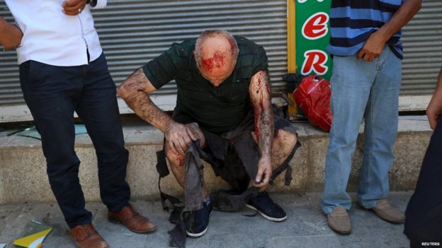 A wounded man sits on a step following an explosion in Suruc