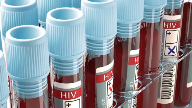 blood test tubes
