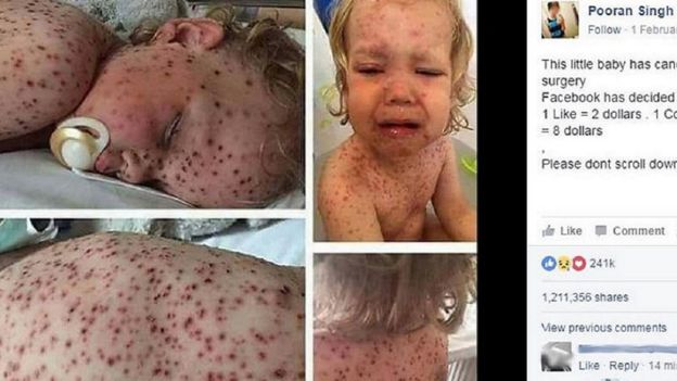 فيسبوك يحذف حسابين بسبب صور مسروقة تدعي إصابة طفل بالسرطان