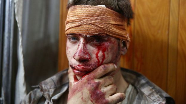 A Syrian man injured in what activists said was a government air strike in the rebel-held Damascus suburb of Douma (16 August 2015)