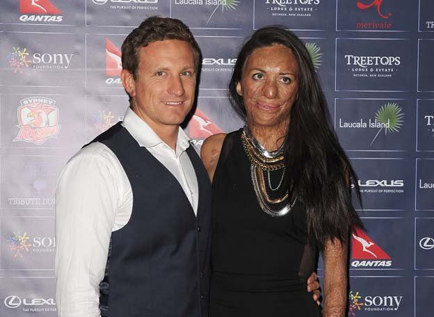 Turia Pitt