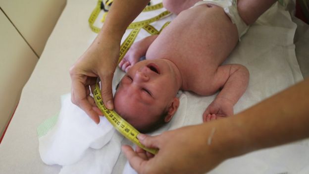 A baby in Recife having its head measured to detect microcephaly