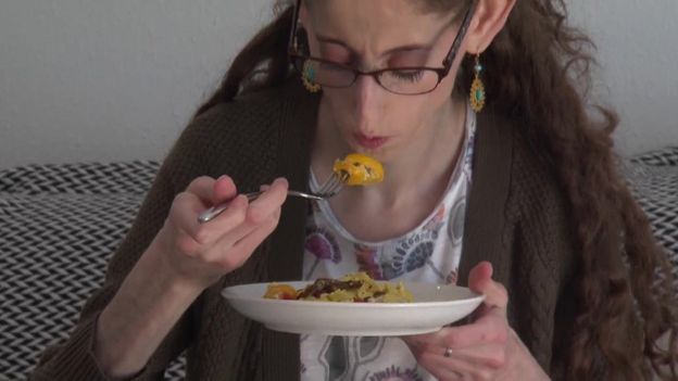 Abby Solomon, estudiante de 21 años que padece síndrome progeroide neonatal