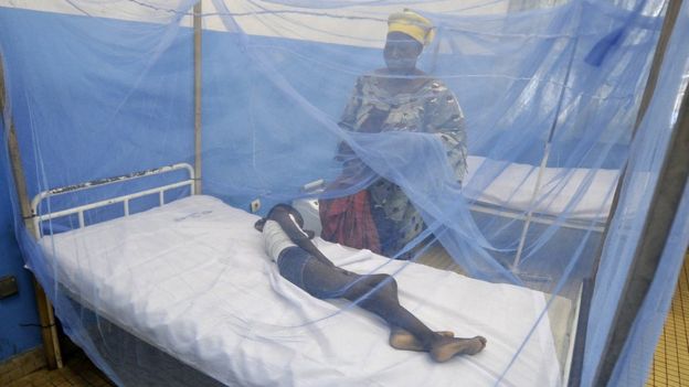 A woman looks at her sick child laying under a mosquito net in Ivory Coast - 2015