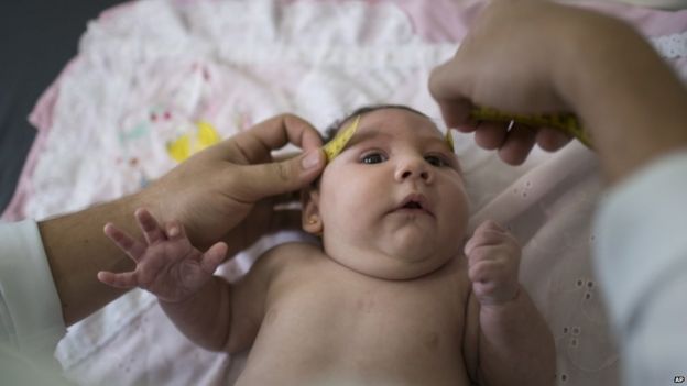 Baby girl having her head measured
