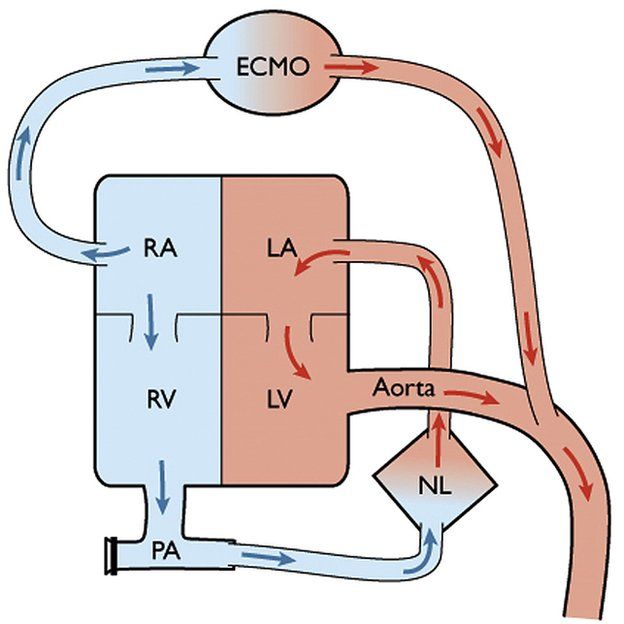 Diagrama