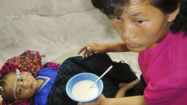 Un niño desnutrido alimentado a base de caldo de avena en Corea del Norte.