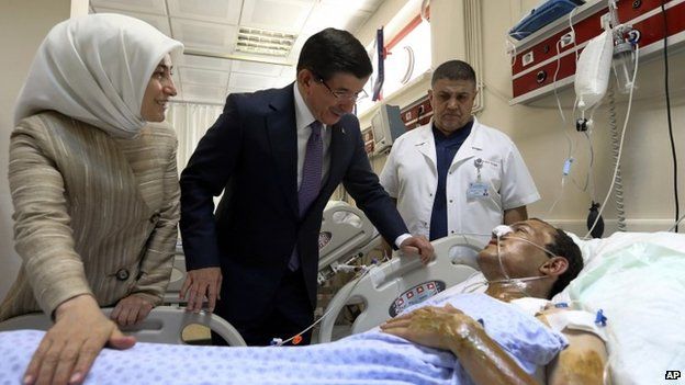 Turkish Prime Minister Ahmet Davutoglu and his wife Sare Davutoglu speak with a man who was injured in a blast in Suruc on Monday, during a visit to a hospital in Sanliurfa, Turkey, Tuesday, July 21, 2015
