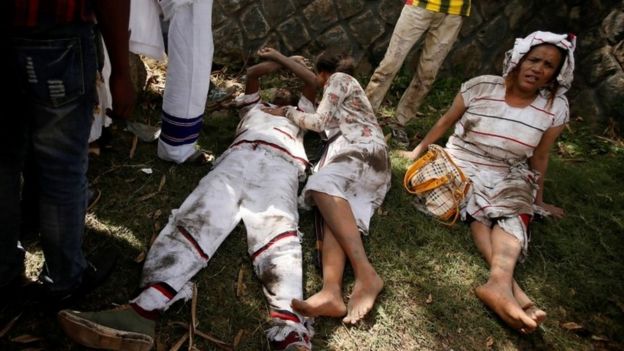 Injured protesters in Bishoftu town, Oromia region, Ethiopia, October 2