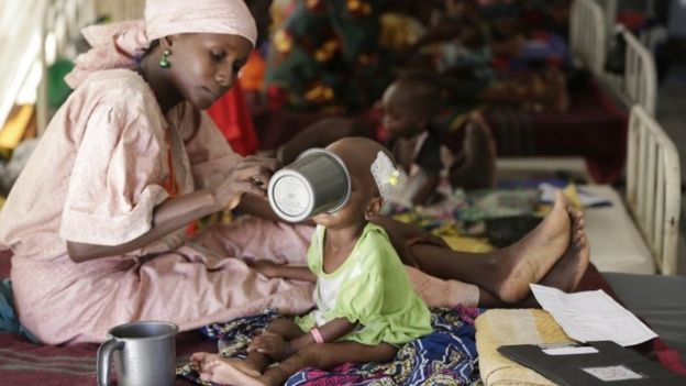 A mother feeds her malnourished child at a feeding centre run by Doctors Without Borders in Maiduguri, Nigeria