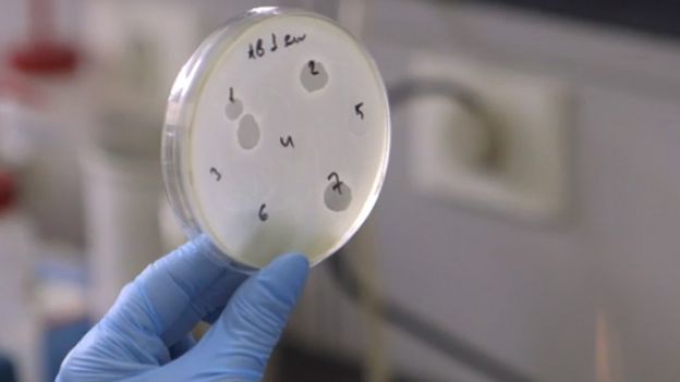 placa de Petri mostrando resultados