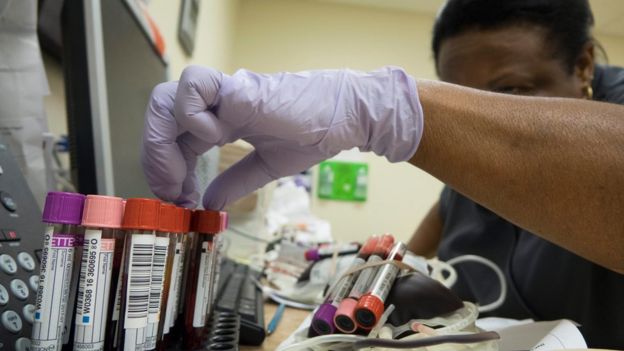 Técnica de laboratorio en el centro de donación One Blood examina las ampolletas con sangre.