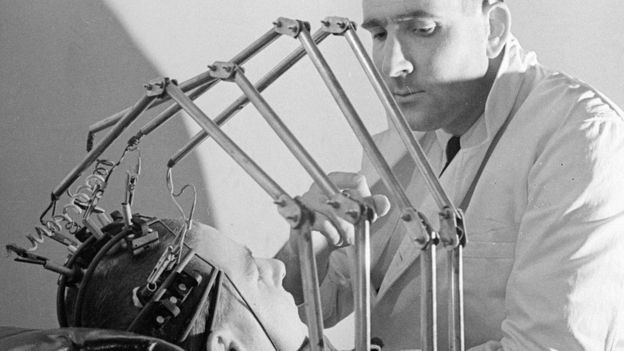 Un doctor en los años 50 con un paciente que tiene unas pinzas conectadas a la cabeza