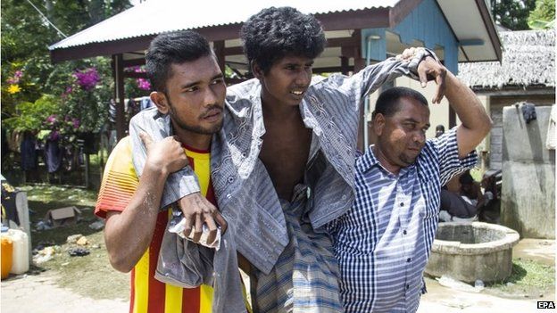 A Rohingya migrant is helped to hospital in Aceh province, Indonesia (10 May 2015)