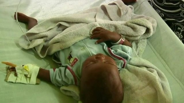 Child suffering from cholera