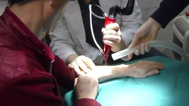Tattoo Removal Korea | tattoo removals for north korea defectors bbc news Tattoo Removal Korea | tattoo removals for north korea defectors bbc news