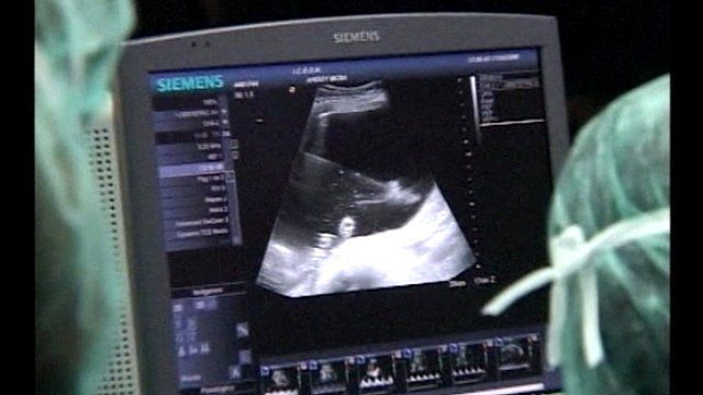 Screening of the operation