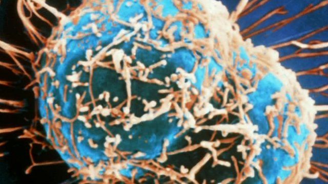 Image of cells