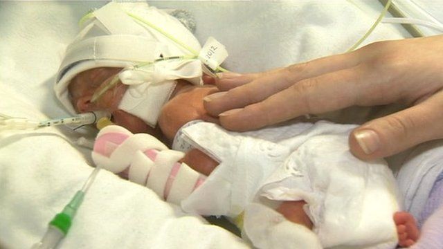 Baby Kai was born at 24 weeks