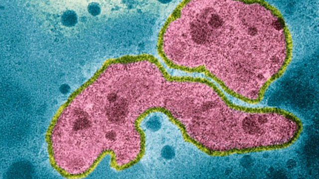 Microscope view of H5N1
