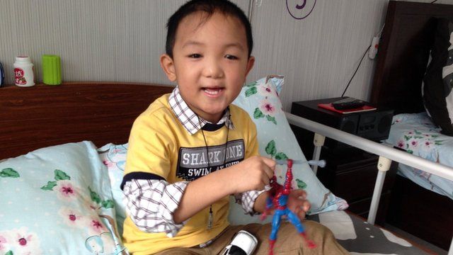 Chinese boy Guo Bin after he was fitted with prosthetic eyes, 22 November 2013