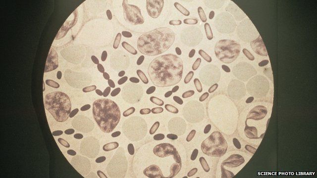 Bubonic plague under a microscope