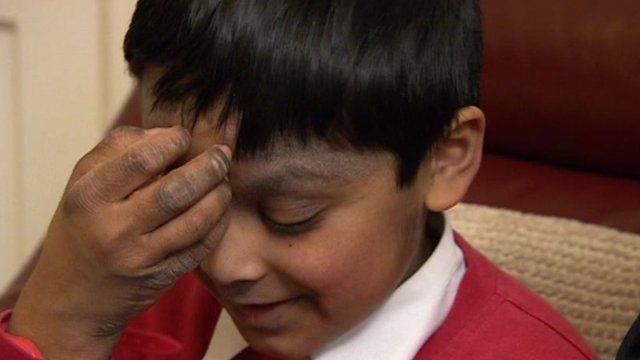 <b>Tahmid Ahmed</b> is taking part in a trial to see if silk clothing will relieve <b>...</b> - _72177294_eczema2