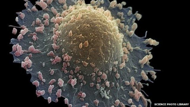 Lung cancer cell