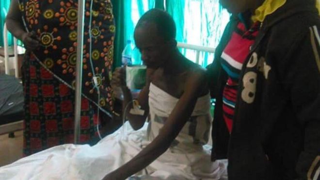 A miner in hospital in western Tanzania (17 November 2015)