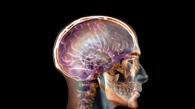 Imagem computadorizada de um cérebro humano