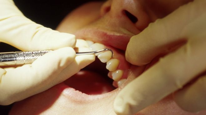 Close shot of a person's mouth undergoing treatment at the dentist
