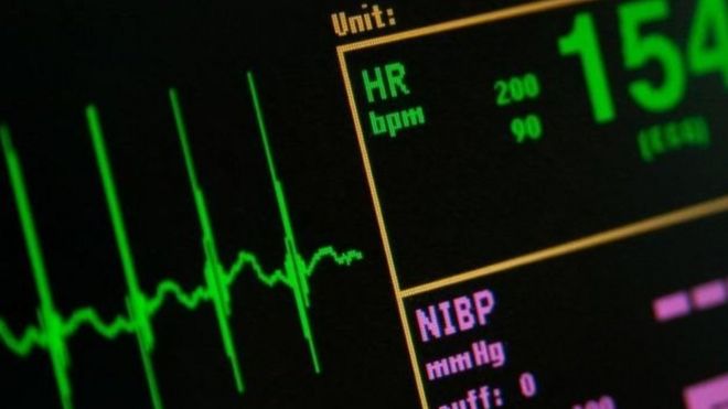 تطبيق هاتفي لمساعدة الأطباء بمستشفيات بريطانية على مراقبة صحة المرضى