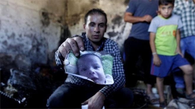Palestinian holds scorched photo of Ali Saad Dawabsha (31/07/15)