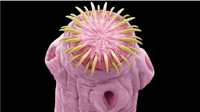 A coloured scan shows the head of a pork tapeworm