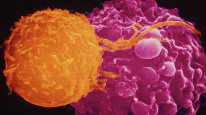 Killer T cell on the attack