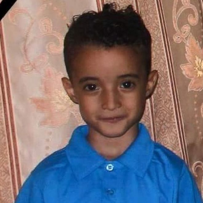 6-year-old Fareed Shawky was seriously injured after a missile hit his house in Yemen's third city of Taiz.