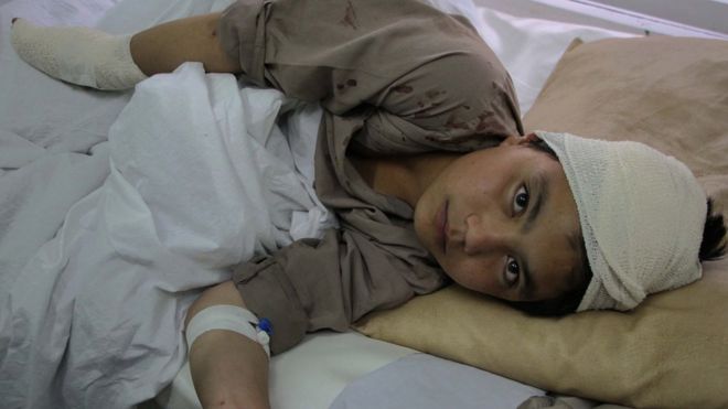 Criança afegã é hospitalizada após um ataque do Taleban em Cabul, em abril deste ano