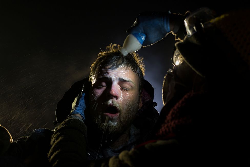 Fotoğrafta bir protestocunun biber gazından yanan gözlerine başka bir protestocu süt döküyor.