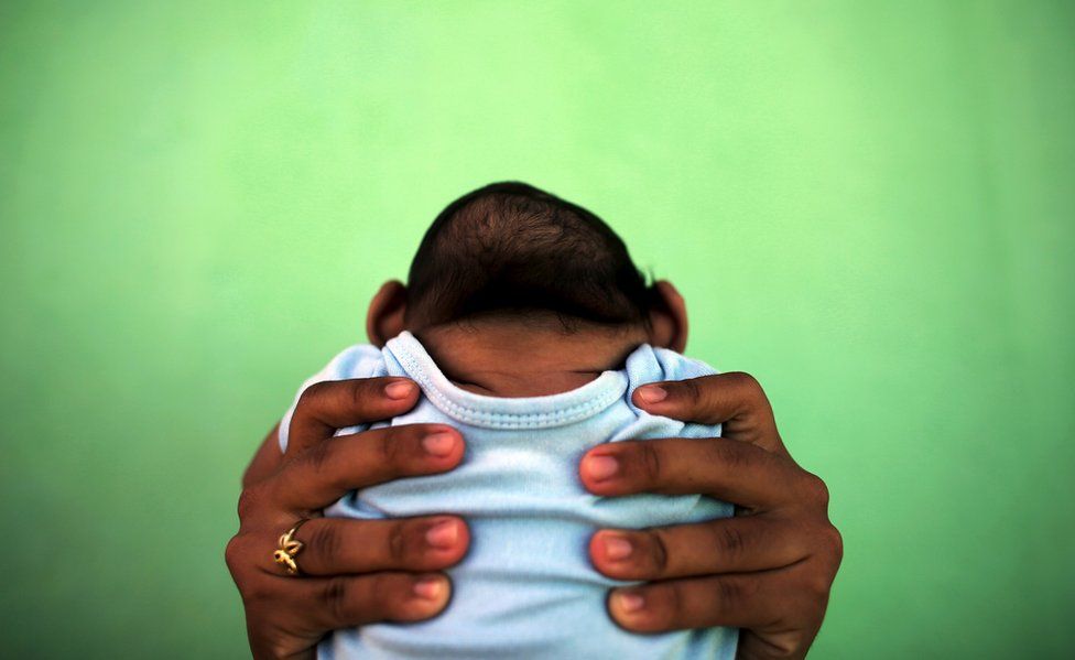 Jackeline, 26, sostiene a su hijo de 4 meses que nació con microcefalia, en Brasil, el 11 de febrero 2016.
