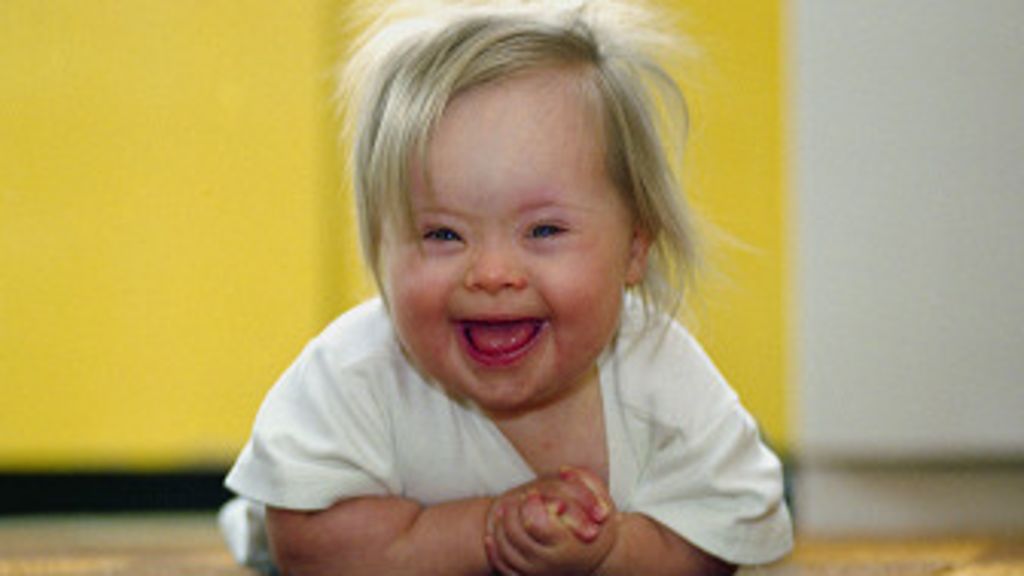 Más cerca de un posible tratamiento del síndrome de Down - BBC Mundo