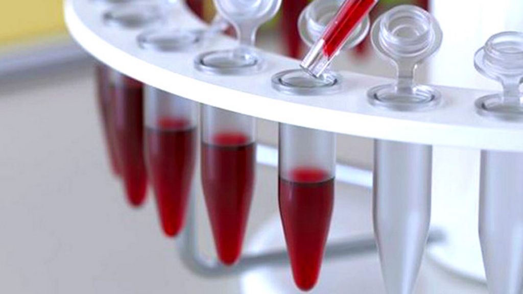 No exame de sangue detecta cancer