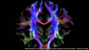 Проводка человеческого мозга Альфреда Анвандера, институт исследований мозга Макса Планка