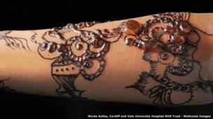 Никола Келли, Университетский госпиталь Кардифа