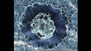 Сильвия А. Феррера, Кристина Лопо и Эйлин Джентельмен, Королевский колледж Лондона