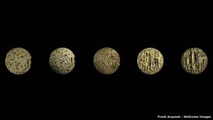 Развитие костей, Фрэнк Акуа