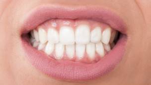 Quienes sufren dismorfia dental tienen una obsesión con la apariencia de sus dientes.