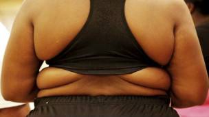 Obesidad