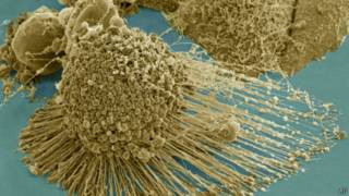 Célula cancerígena de Henrietta Lacks | Foto: AP