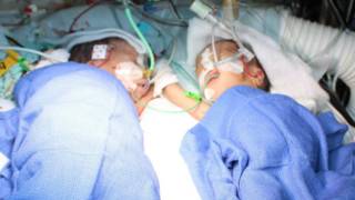 160131234553_siamesas_suiza_624x351_epa_