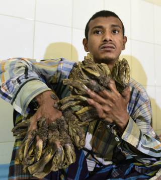 160202165910_hombre_arbol_624x700_getty_